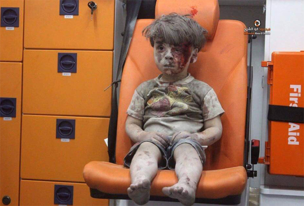 Video Bocah Aleppo Korban Serangan Udara Assad Menjadi viral