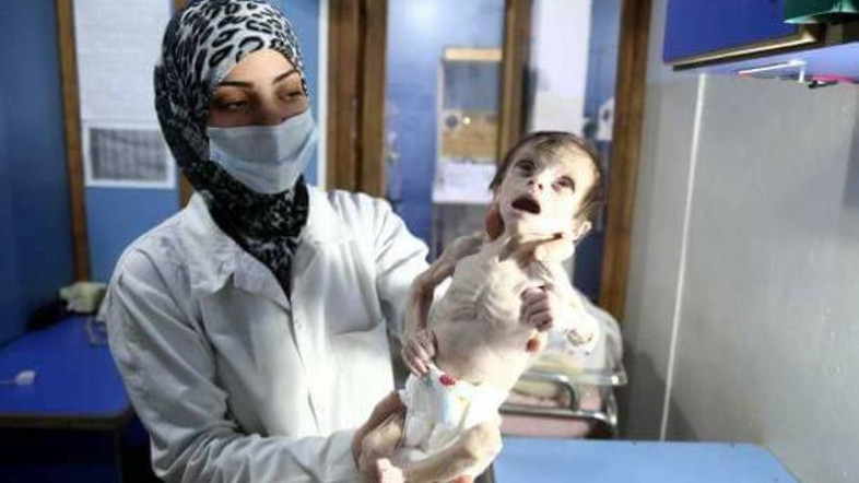 Sahar, 1 Diantara Ratusan Balita yang Tewas Kelaparan Akibat Pengepungan Rezim Assad