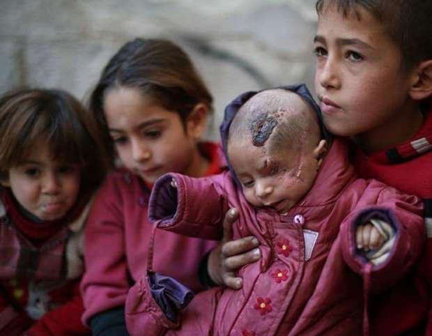 Dukungan Dunia untuk Bayi Suriah yang Dibom Rezim Syiah Assad di Ghouta Timur