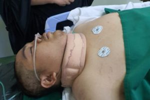 Mahasiswa Universitas Al Azhar Kritis, Pendarahan Diotak hingga Patah Tulang
