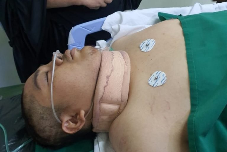 Mahasiswa Universitas Al Azhar Kritis, Pendarahan Diotak hingga Patah Tulang