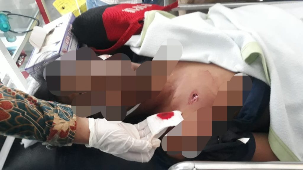 Mahasiswa Kendari Tewas Saat Demo, Polisi: Anggota Hanya Dibekali Tameng