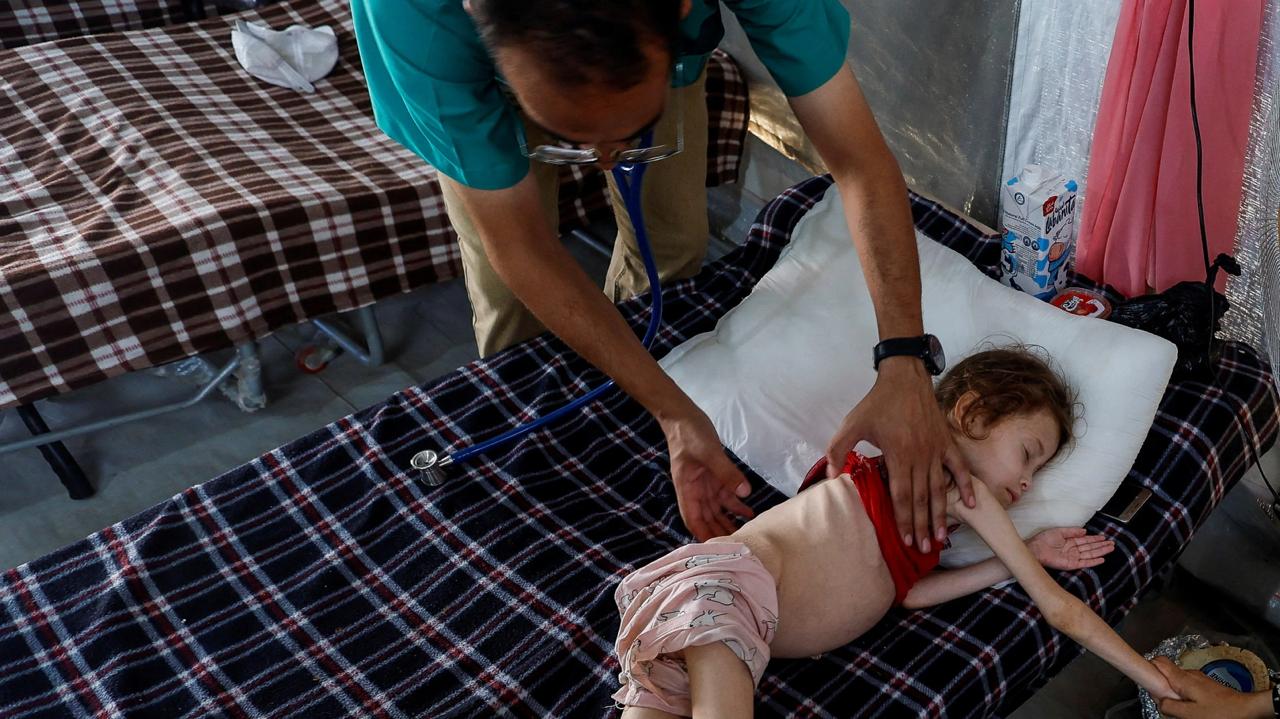 Inggris Siapkan Evakuasi Ratusan Anak Gaza untuk Perawatan Medis