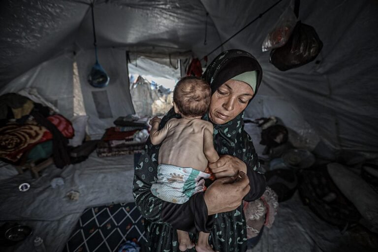 Kelaparan di Gaza Tewaskan 217 Orang, Termasuk 100 Anak